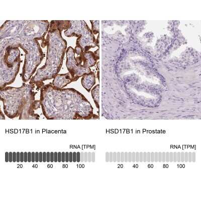 Immunohistochemistry-Paraffin: 17 beta-HSD1/HSD17B1 Antibody [NBP2-39053]