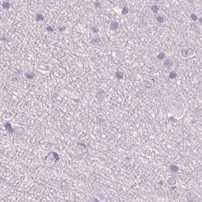 Immunohistochemistry-Paraffin: 17 beta-HSD1/HSD17B1 Antibody [NBP2-39053]