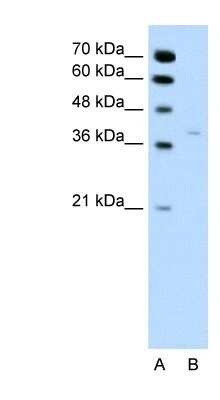 Western Blot: 17 beta-HSD1/HSD17B1 Antibody [NBP1-56295]