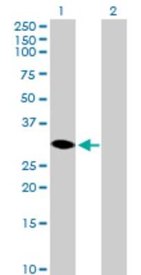 Western Blot: 17 beta-HSD14/HSD17B14 Antibody [H00051171-B01P]