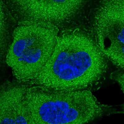Immunocytochemistry/ Immunofluorescence: 26S proteasome subunit 9 Antibody [NBP2-47561]