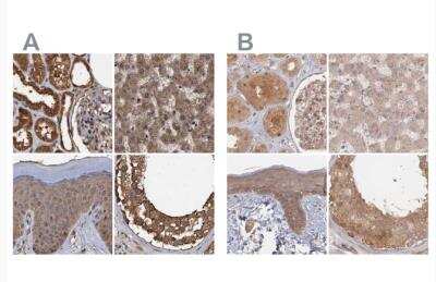 Immunohistochemistry-Paraffin: 26S proteasome subunit 9 Antibody [NBP2-47561]