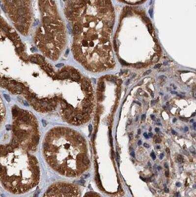 Immunohistochemistry-Paraffin: 26S proteasome subunit 9 Antibody [NBP2-47561]