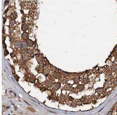 Immunohistochemistry-Paraffin: 26S proteasome subunit 9 Antibody [NBP2-47561]