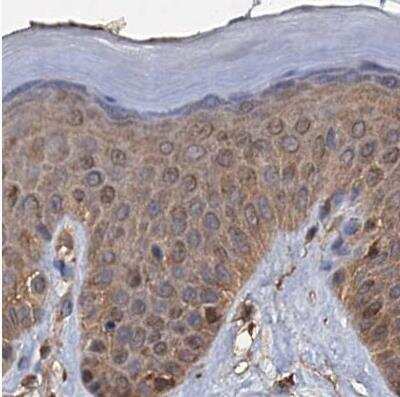 Immunohistochemistry-Paraffin: 26S proteasome subunit 9 Antibody [NBP2-47561]
