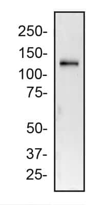Western Blot Detection of 2A Peptide in HeLa Cells