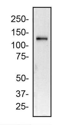 Western Blot Detection of 2A Peptide in HeLa Cells