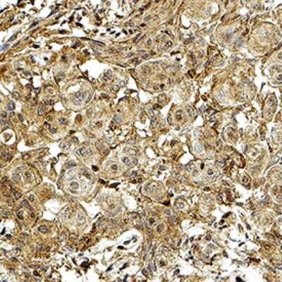 Immunohistochemistry-Paraffin: 3-OHKYN Antibody (P3UI) - Azide and BSA Free [NBP2-80548]