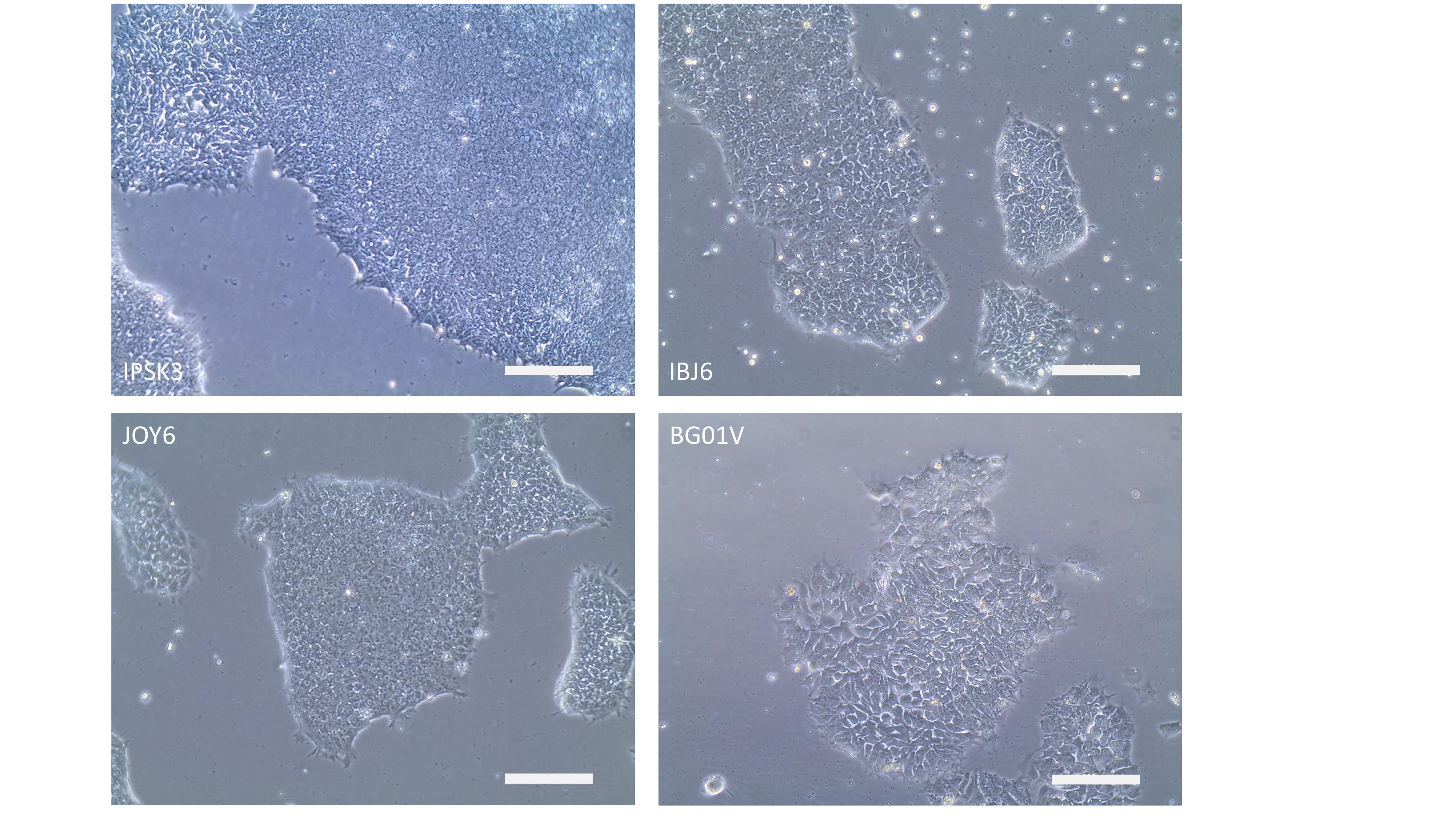 Human iPSC and ESC Colony Formation_Cultrex ReadyBME_3434-050-RTU