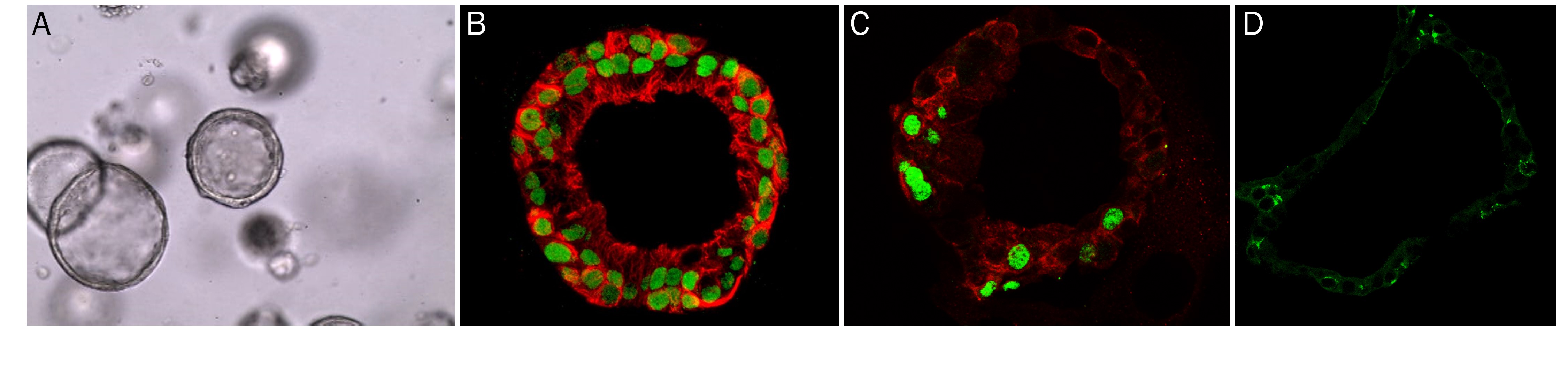Human Lung Organoids Cultured in Cultrex RGF BME, Type 2