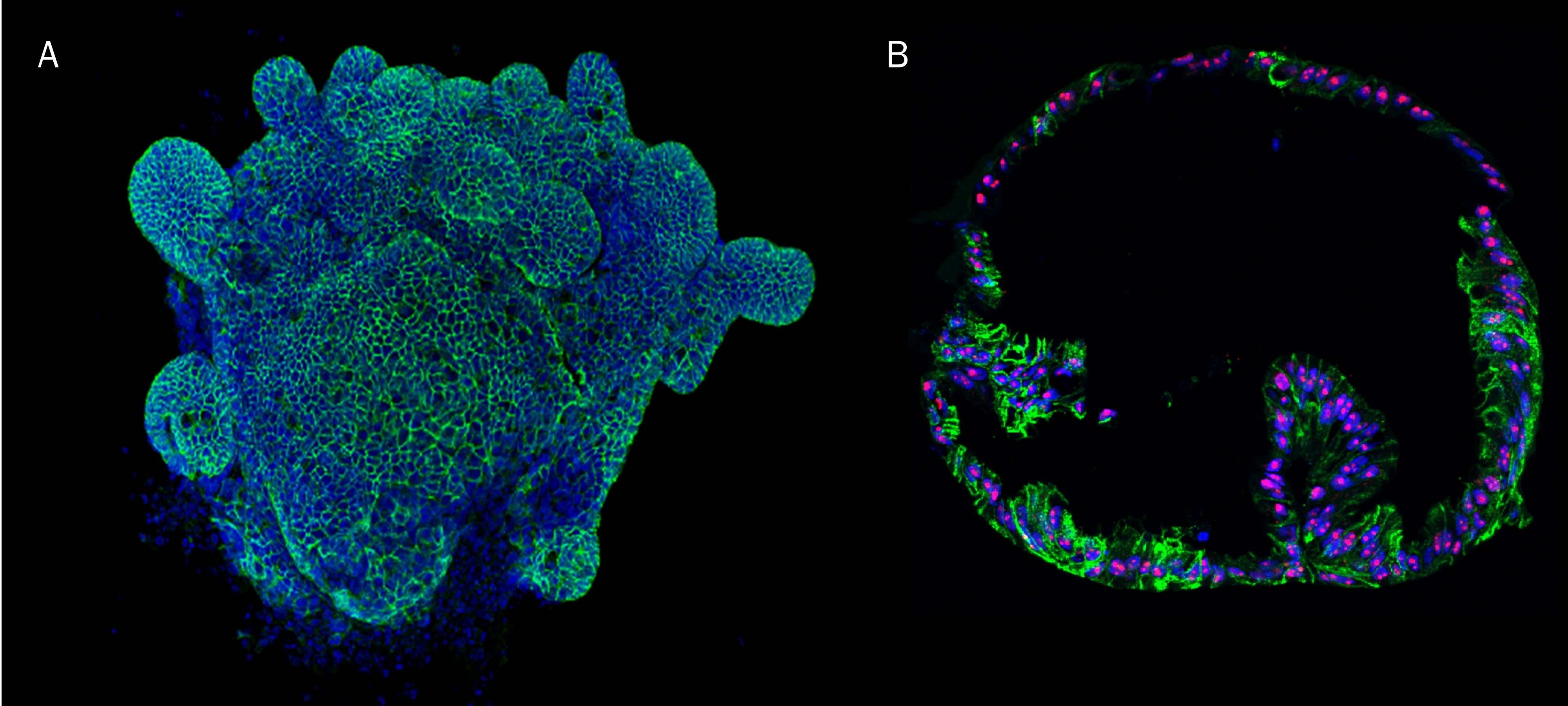Mouse Intestinal Organoids Cultured in Cultrex RGF BME Type 2_3533-005-02