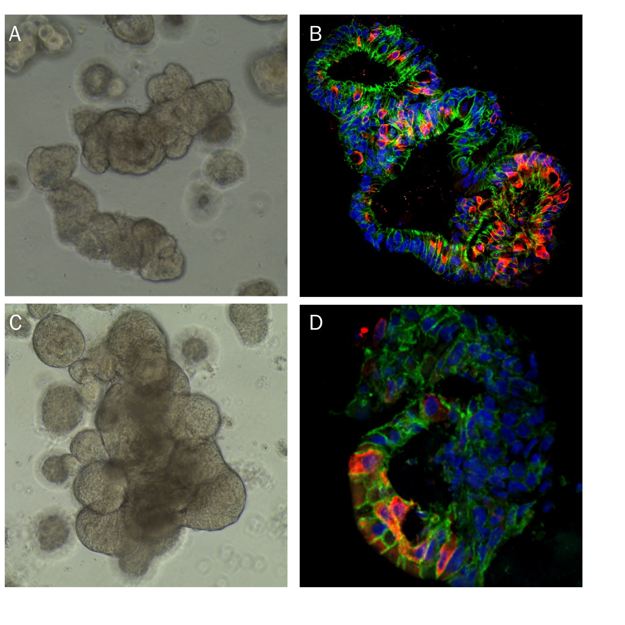 Human Intestinal Organoids Cultured using Cultrex RGF BME
