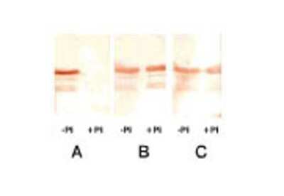 Western Blot: Troponin I Type 3 (cardiac) Antibody (22B11) [NB120-8290]
