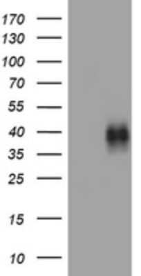 Western Blot: 4-1BB/TNFRSF9/CD137 Antibody (OTI5H5)Azide and BSA Free [NBP2-71035]