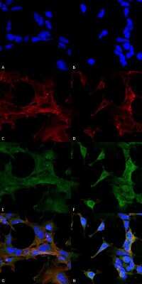 Immunocytochemistry/ Immunofluorescence: 4-Hydroxy-2-hexenal Antibody (6F10) [NBP2-59352]