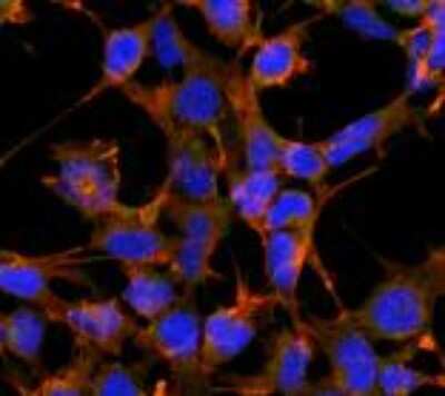 Immunocytochemistry/ Immunofluorescence: 4-Hydroxynonenal Antibody (12F7) [NBP2-59353]