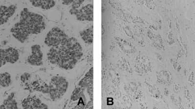 Immunohistochemistry: 4-amino Biphenyl DNA Antibody (4C11) [NB100-415]