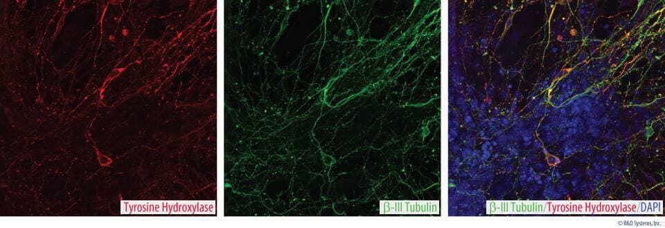 Staining of dopaminergic neurons with anti-tyrosine hydroxylase in red, anti-neuron-specific beta III tubulin Tuj1 in green and DAPI in blue.