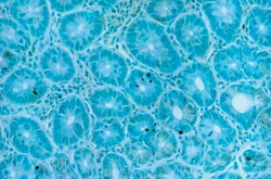 TumorTACS In Situ Apoptosis Detection Kit_Mammary Tumor_4815-30-K