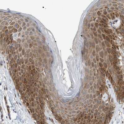 Immunohistochemistry-Paraffin: 4EBP1 Antibody [NBP1-89368]