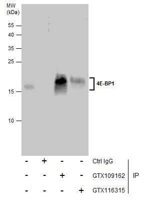Immunoprecipitation: 4EBP1 Antibody [NBP2-16307]
