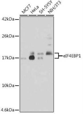 Western Blot: 4EBP1 AntibodyAzide and BSA Free [NBP3-02995]
