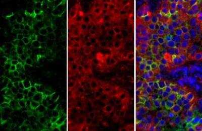 Immunohistochemistry-Paraffin: 5'-Nucleotidase/CD73 Antibody [NBP2-15815]