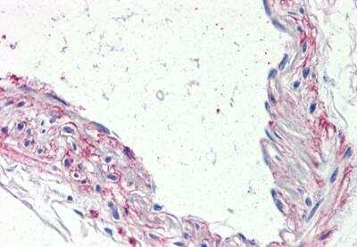 Immunohistochemistry-Paraffin: 5-HT1B Antibody - BSA Free [NBP3-06662]
