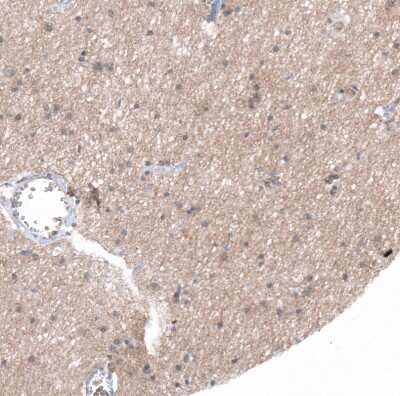Immunohistochemistry-Paraffin: 5-HT1E Antibody [NBP1-90320]