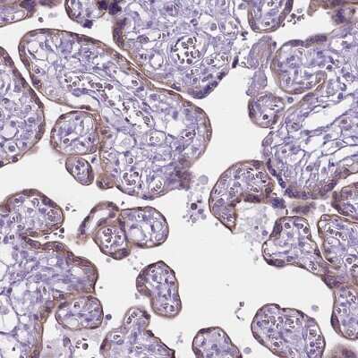 Immunohistochemistry-Paraffin: 5-HT2B Antibody [NBP1-90322]
