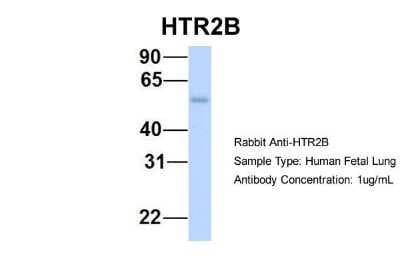 Western Blot: 5-HT2B Antibody [NBP1-55429]