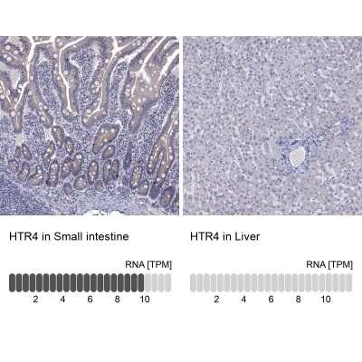 Immunohistochemistry-Paraffin: 5-HT4 Antibody [NBP2-14109]