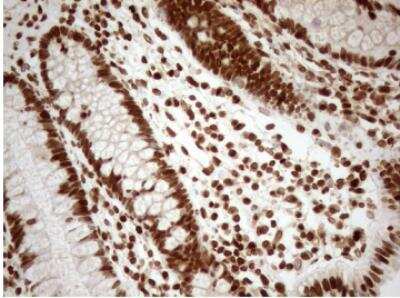 Immunohistochemistry-Paraffin: 5-Lipoxygenase Antibody (OTI3F1) [NBP2-46513]