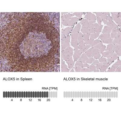 Immunohistochemistry-Paraffin: 5-Lipoxygenase Antibody [NBP2-56011]