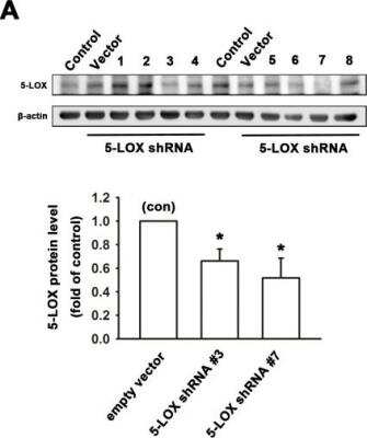 Knockdown Validated: 5-Lipoxygenase Antibody - BSA Free [NB110-58748]