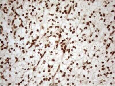 Immunohistochemistry: 5-Lipoxygenase Antibody (OTI3F1) - Azide and BSA Free [NBP2-70166]