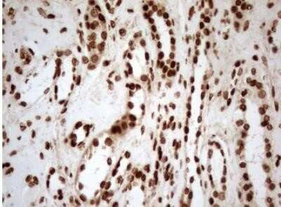 Immunohistochemistry: 5-Lipoxygenase Antibody (OTI3F1) - Azide and BSA Free [NBP2-70166]