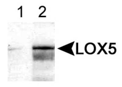 Western Blot: 5-Lipoxygenase AntibodyBSA Free [NB110-58748]