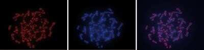 In-situ Hybridization: 5-MethylCytosine Antibody (15H61) [NBP2-59166]