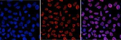Immunocytochemistry/ Immunofluorescence: 5-MethylCytosine Antibody (15H61) [NBP2-59166]
