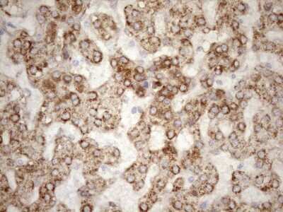Immunohistochemistry: 5'-Nucleotidase/CD73 Antibody (OTI1G2) [NBP2-46259]