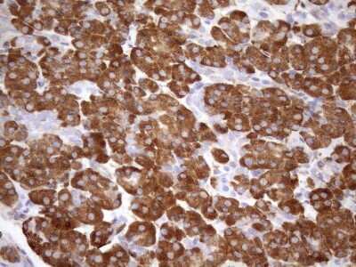 Immunohistochemistry: 5'-Nucleotidase/CD73 Antibody (OTI1G2) [NBP2-46259]