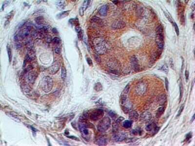 Immunohistochemistry-Paraffin: 5'-Nucleotidase/CD73 Antibody (45M4F9) - Azide Free [NBP2-25243]