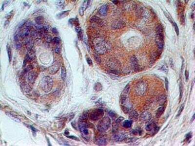 Immunohistochemistry-Paraffin: 5'-Nucleotidase/CD73 Antibody (45M4F9) - BSA Free [NBP2-25237]