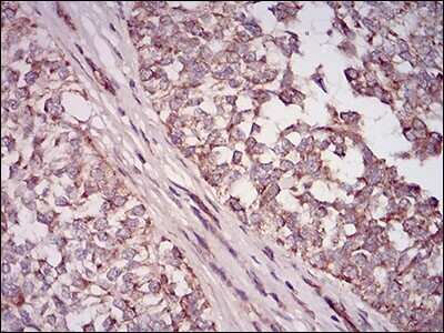 Immunohistochemistry-Paraffin: 5'-Nucleotidase/CD73 Antibody (4G6B10) - BSA Free [NBP2-37274]