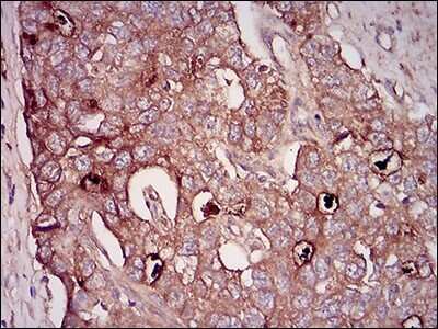 Immunohistochemistry-Paraffin: 5'-Nucleotidase/CD73 Antibody (4G6B10) - BSA Free [NBP2-37274]