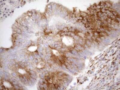 Immunohistochemistry: 5'-Nucleotidase/CD73 Antibody (OTI1G2) - Azide and BSA Free [NBP2-71214]