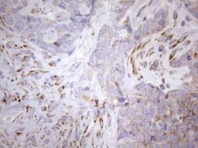 Immunohistochemistry: 5'-Nucleotidase/CD73 Antibody (OTI1G2) - Azide and BSA Free [NBP2-71214]