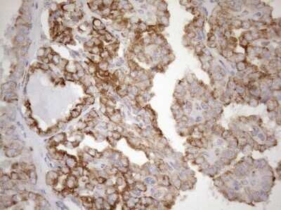 Immunohistochemistry: 5'-Nucleotidase/CD73 Antibody (OTI1G2) - Azide and BSA Free [NBP2-71214]