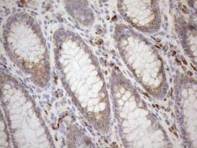 Immunohistochemistry: 5'-Nucleotidase/CD73 Antibody (OTI1G2) - Azide and BSA Free [NBP2-71214]